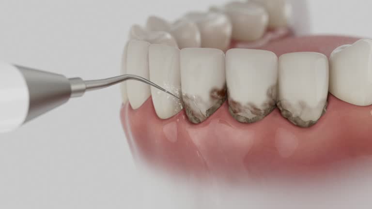Trusted Teeth Cleaning And Checkup service in Jersey Shore, PA - Dentist Open Now